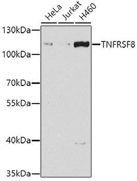 Cell Biology Antibodies 11 Anti-TNFRSF8 Antibody CAB7651