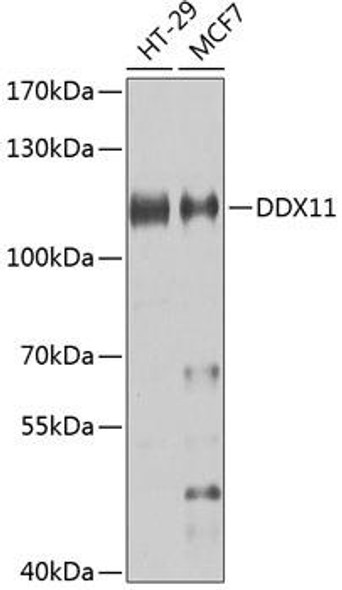 ChIP Antibodies Anti-DDX11 Antibody CAB7666