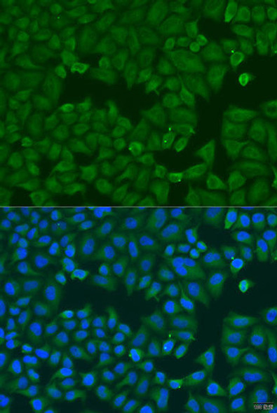 Cell Biology Antibodies 11 Anti-KRT6B Antibody CAB7696