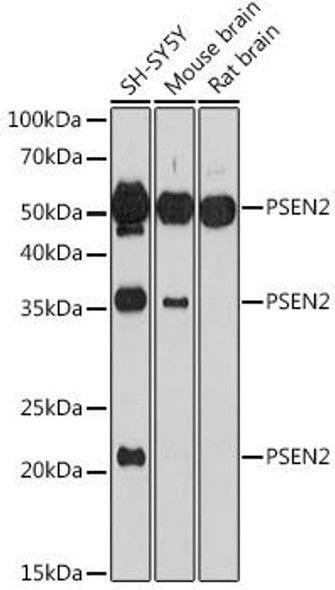 Signal Transduction Antibodies 3 Anti-PSEN2 Antibody CAB7719