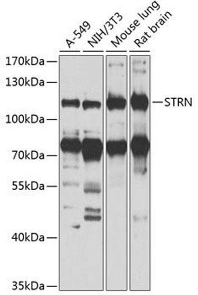 Cell Biology Antibodies 11 Anti-STRN Antibody CAB7734