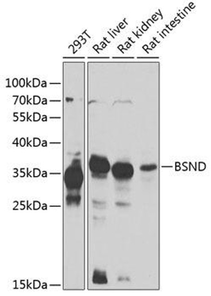 Cell Biology Antibodies 11 Anti-BSND Antibody CAB7747