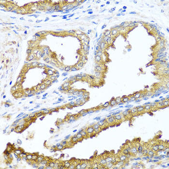 Signal Transduction Antibodies 3 Anti-NCK2 Antibody CAB7750