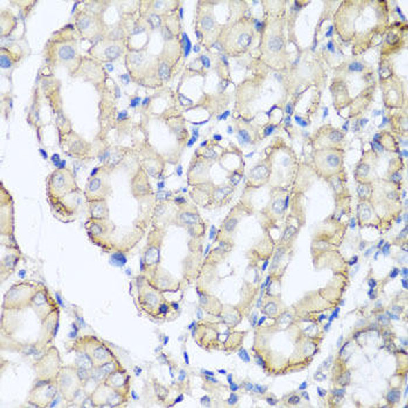 Metabolism Antibodies 2 Anti-AHCYL1 Antibody CAB7773