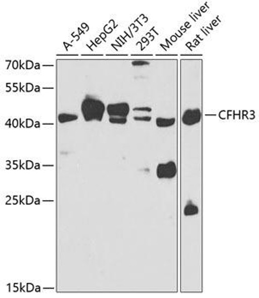 Cell Biology Antibodies 11 Anti-CFHR3 Antibody CAB7775