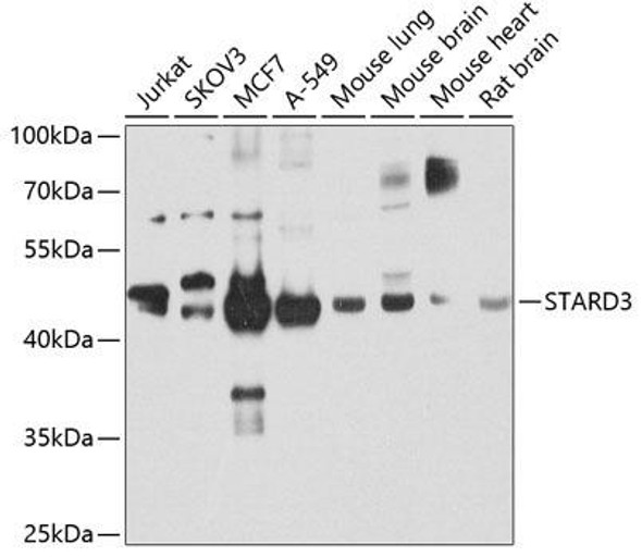 Cell Biology Antibodies 11 Anti-STARD3 Antibody CAB7776