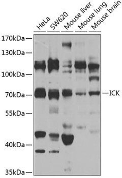 Cell Biology Antibodies 11 Anti-ICK Antibody CAB7783