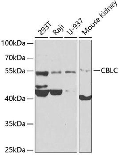 Signal Transduction Antibodies 3 Anti-CBLC Antibody CAB7789