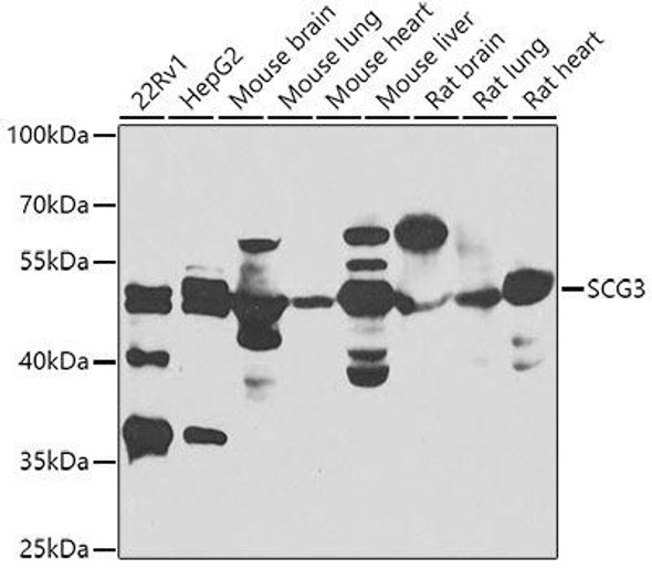 Cell Biology Antibodies 11 Anti-SCG3 Antibody CAB7799