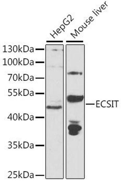 Immunology Antibodies 2 Anti-ECSIT Antibody CAB7804