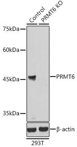 KO Validated Antibodies 1 Anti-PRMT6 Antibody CAB7814KO Validated