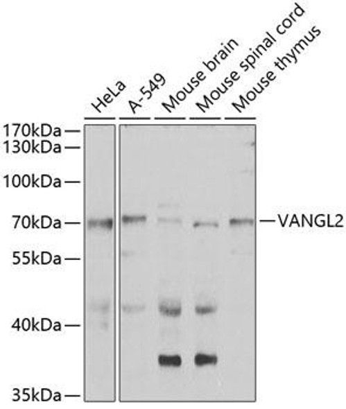 Cell Biology Antibodies 11 Anti-VANGL2 Antibody CAB7825