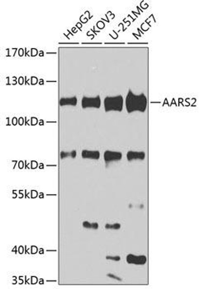 Metabolism Antibodies 2 Anti-AARS2 Antibody CAB7826