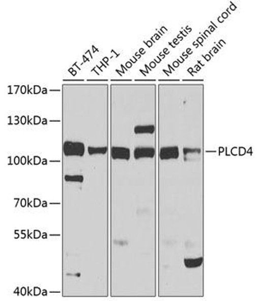 Metabolism Antibodies 2 Anti-PLCD4 Antibody CAB7841