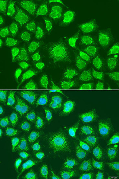 Cell Death Antibodies 2 Anti-ATG4D Antibody CAB7842