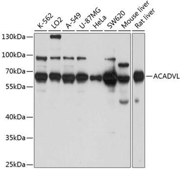 Metabolism Antibodies 2 Anti-ACADVL Antibody CAB7865