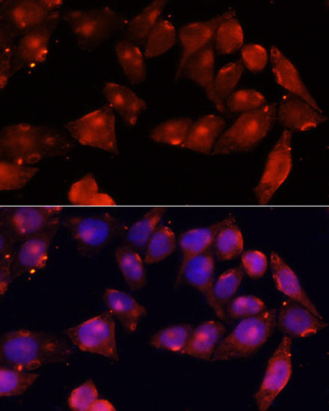 Cell Biology Antibodies 11 Anti-ACVR2B Antibody CAB7868