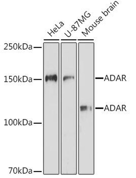 Immunology Antibodies 2 Anti-ADAR Antibody CAB7869