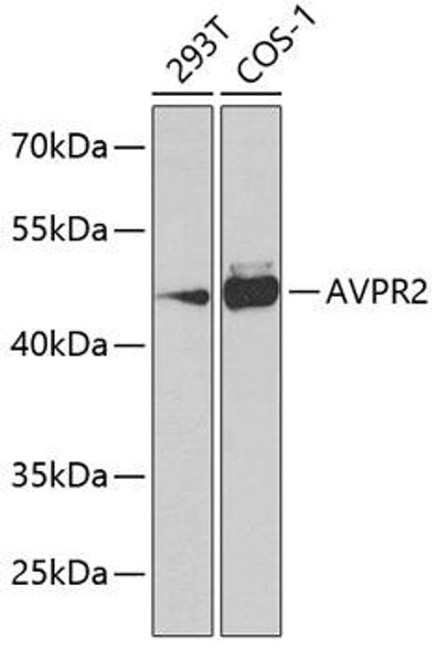Cell Biology Antibodies 11 Anti-AVPR2 Antibody CAB7879