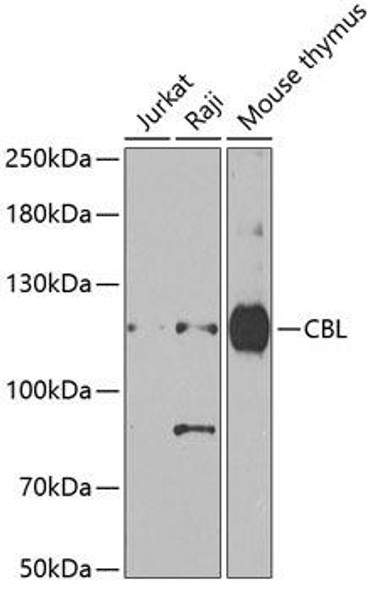 Signal Transduction Antibodies 3 Anti-CBL Antibody CAB7881