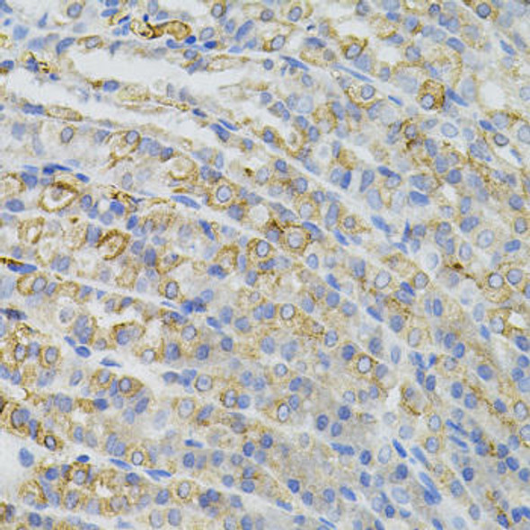 Signal Transduction Antibodies 3 Anti-CBL Antibody CAB7881