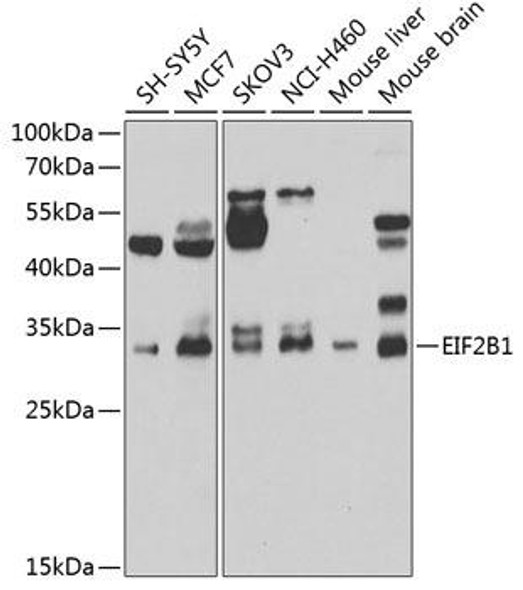 Metabolism Antibodies 2 Anti-EIF2B1 Antibody CAB7892