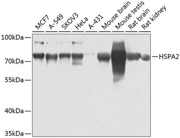 Developmental Biology Anti-HSPA2 Antibody CAB7902