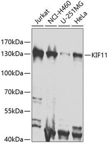 Cell Cycle Antibodies 2 Anti-KIF11 Antibody CAB7907