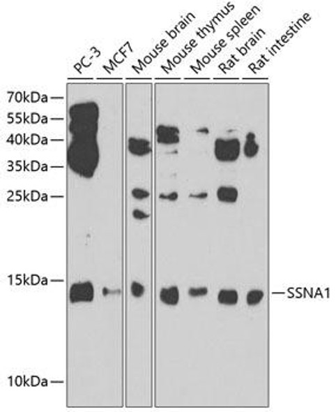 Cell Biology Antibodies 11 Anti-SSNA1 Antibody CAB7944