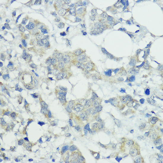 Developmental Biology Anti-SOCS5 Antibody CAB7952