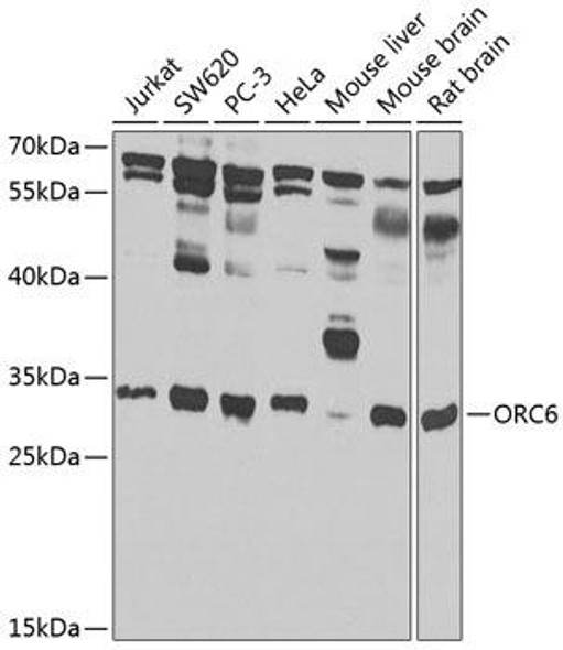 Epigenetics and Nuclear Signaling Antibodies 4 Anti-ORC6 Antibody CAB7966