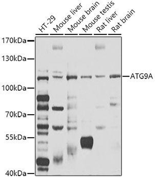 Autophagy Antibodies Anti-ATG9A Antibody CAB7994