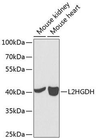 Cell Biology Antibodies 11 Anti-L2HGDH Antibody CAB7996