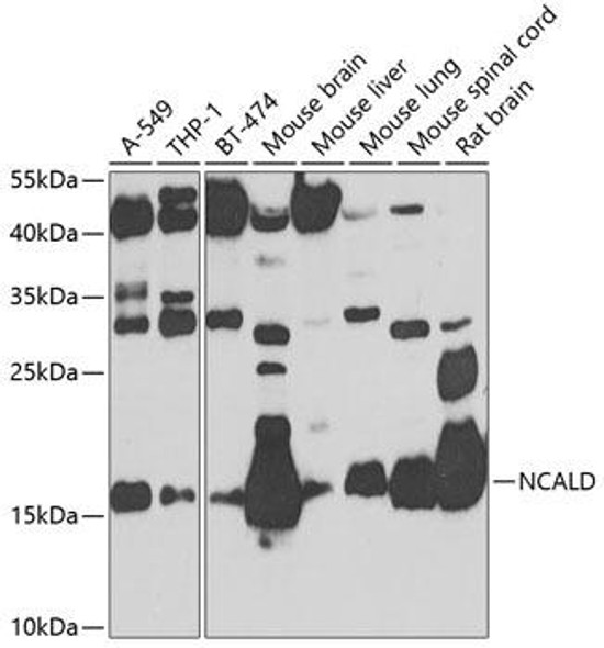 Cell Biology Antibodies 11 Anti-Neurocalcin-delta Antibody CAB8000
