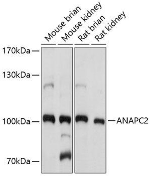 Cell Cycle Antibodies 2 Anti-ANAPC2 Antibody CAB8066