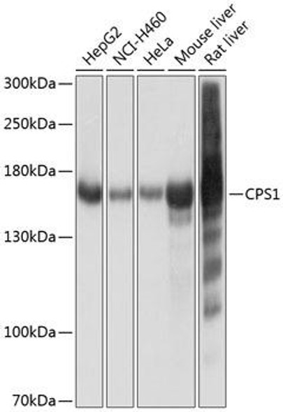Metabolism Antibodies 3 Anti-CPS1 Antibody CAB8080