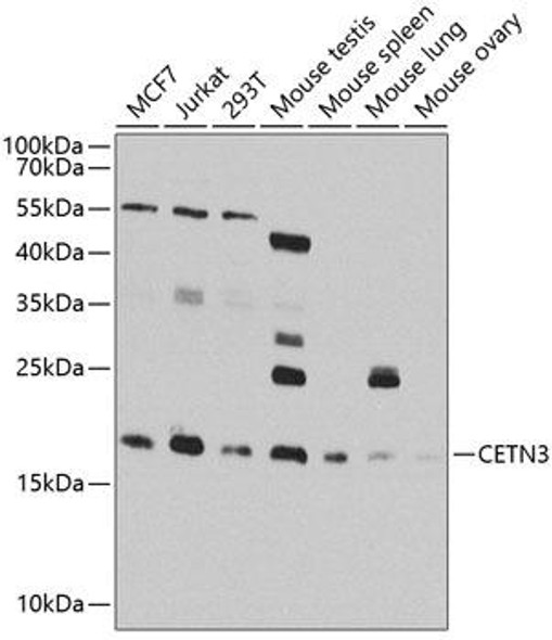 Cell Cycle Antibodies 2 Anti-Centrin-3 Antibody CAB8111