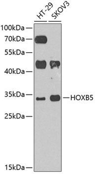 Epigenetics and Nuclear Signaling Antibodies 4 Anti-HOXB5 Antibody CAB8123