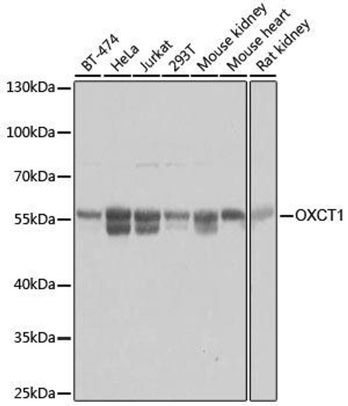 KO Validated Antibodies 1 Anti-OXCT1 Antibody CAB8139KO Validated