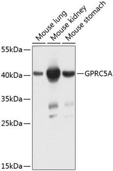 Cell Biology Antibodies 12 Anti-GPRC5A Antibody CAB8173