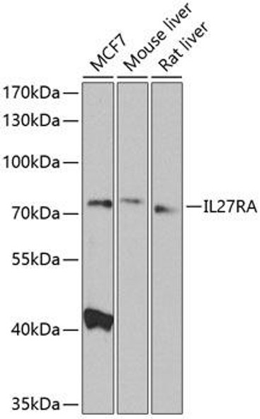Cell Biology Antibodies 12 Anti-IL27RA Antibody CAB8176
