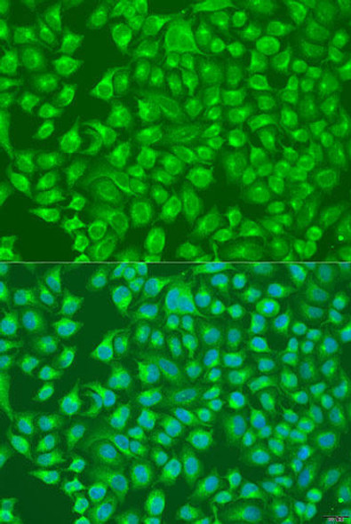 Signal Transduction Antibodies 3 Anti-SLC12A6 Antibody CAB8180