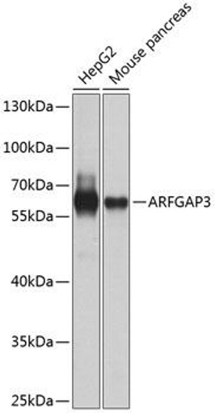 Cell Biology Antibodies 12 Anti-ARFGAP3 Antibody CAB8204