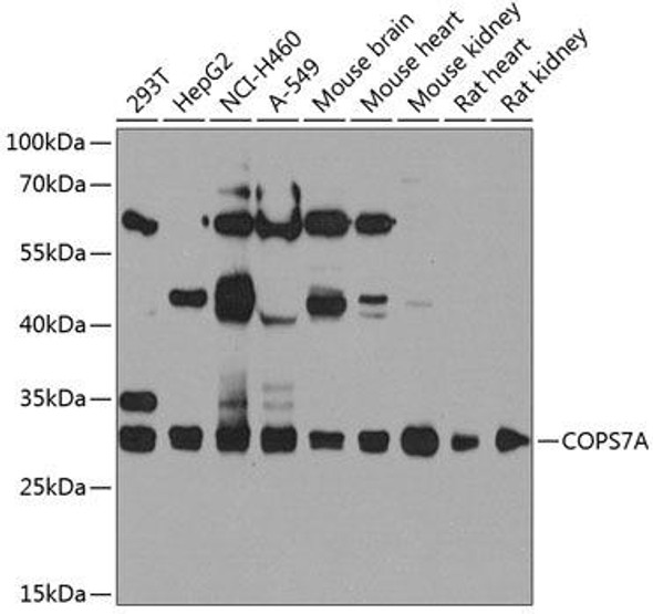 Immunology Antibodies 3 Anti-COPS7A Antibody CAB8212