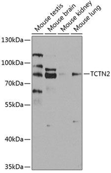 Cell Biology Antibodies 12 Anti-Tectonic-2 Antibody CAB8260