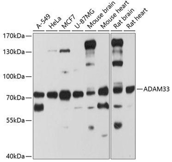 Cell Biology Antibodies 12 Anti-ADAM33 Antibody CAB8265