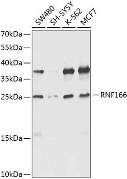 Autophagy Antibodies Anti-RNF166 Antibody CAB8276