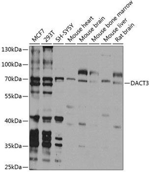 Metabolism Antibodies 3 Anti-Dapper homolog 3 Antibody CAB8280