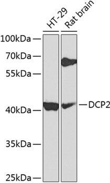 Epigenetics and Nuclear Signaling Antibodies 4 Anti-DCP2 Antibody CAB8282