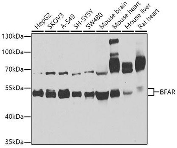 Cell Death Antibodies 2 Anti-BFAR Antibody CAB8308